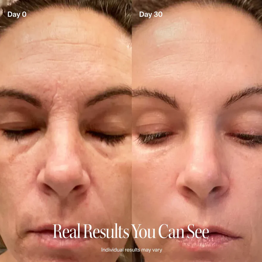 Smooth fine lines in 3 minutes a day.